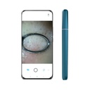 Wisdom Akıllı Pore Cleaner with Kamera